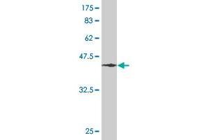 Western Blot detection against Immunogen (46. (RHOA antibody  (AA 1-193))