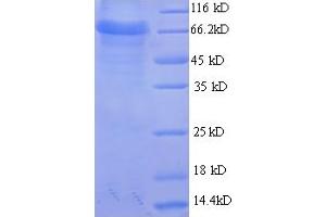 SDS-PAGE (SDS) image for Glucuronic Acid Epimerase (GLCE) (AA 29-617) protein (His tag) (ABIN5709583) (GLCE Protein (AA 29-617) (His tag))