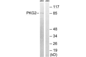 Western Blotting (WB) image for anti-Protein Kinase, CGMP-Dependent, Type II (PRKG2) (Ser126) antibody (ABIN1848262) (PRKG2 antibody  (Ser126))