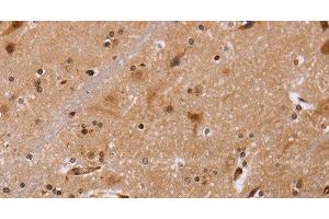 Immunohistochemistry of paraffin-embedded Human brain tissue using FBP2 Polyclonal Antibody at dilution 1:40 (FBP2 antibody)