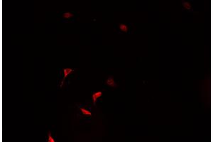 ABIN6266928 staining HeLa  cells by IF/ICC. (ZNF187 antibody  (Internal Region))