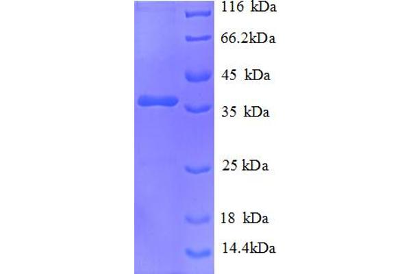 NDUFA2 Protein (AA 4-99, partial) (GST tag)