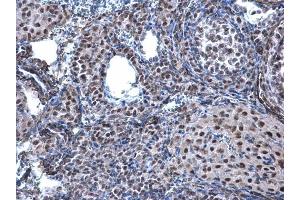 IHC-P Image CBX1 / HP1 beta antibody detects CBX1 / HP1 beta protein at nucleus on mouse ovary by immunohistochemical analysis. (CBX1 antibody  (Center))
