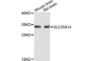 Western blot analysis of extracts of various cell lines, using SLC25A14 antibody (ABIN6291469) at 1:3000 dilution. (SLC25A14 antibody)