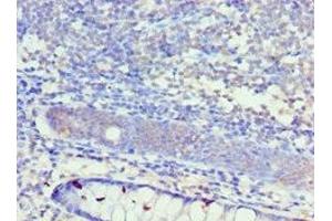 Immunohistochemistry of paraffin-embedded human colon tissue using ABIN7156944 at dilution of 1:100 (KCNN4 antibody  (AA 288-427))