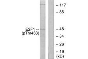 Western blot analysis of extracts from HeLa cells treated with Etoposide 25uM 24h, using E2F1 (Phospho-Thr433) Antibody. (E2F1 anticorps  (pThr433))