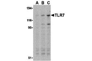 Western Blotting (WB) image for anti-Toll-Like Receptor 7 (TLR7) (Middle Region) antibody (ABIN1031131) (TLR7 antibody  (Middle Region))