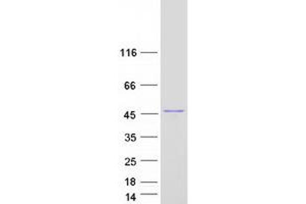 BCS1L Protein (Transcript Variant 2) (Myc-DYKDDDDK Tag)