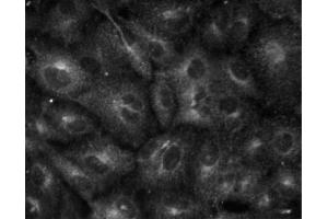 Immunofluorescent staining of A549 (ATCC CCL-185) cells. (pi 4-Kinase, beta (AA 411-626) antibody)