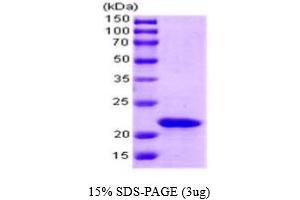 SDS-PAGE (SDS) image for SlyD (AA 1-196) protein (ABIN667072) (SlyD (AA 1-196) Protein)