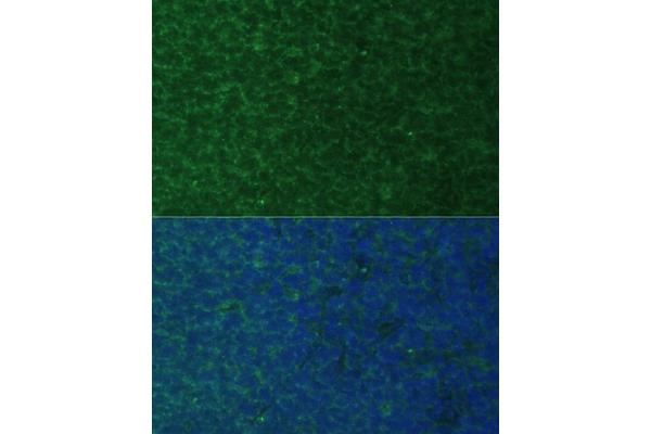 NOXA antibody  (AA 1-54)