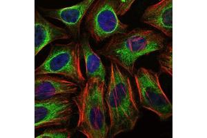 Immunofluorescence (IF) image for anti-Cas-Br-M (Murine) Ecotropic Retroviral Transforming Sequence (CBL) antibody (ABIN968993)