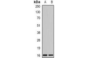 Western blot analysis of MYL2 expression in MCF7 (A), mouse skeletal muscle (B) whole cell lysates. (MYL2 antibody)