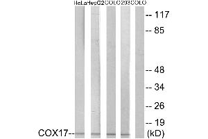 Immunohistochemistry analysis of paraffin-embedded human liver carcinoma tissue using COX17 antibody. (COX17 antibody)