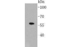 Lane 1: A549 Cell lysates, probed with Smad3 (3D1) Monoclonal Antibody  at 1:1000 overnight at 4˚C. (SMAD3 antibody)