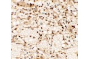 Immunohistochemistry (IHC) image for anti-C-Type Lectin Domain Family 7, Member A (CLEC7A) (Middle Region) antibody (ABIN1030907) (CLEC7A antibody  (Middle Region))