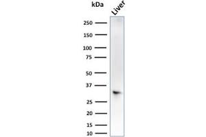 SULT1E1 antibody