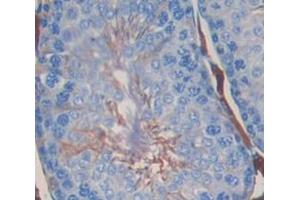 IHC-P analysis of Kidney tissue, with DAB staining. (Dickkopf-Like 1 (DKKL1) (AA 21-230) antibody)