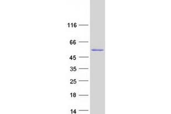 TBRG1 Protein (Transcript Variant 1) (Myc-DYKDDDDK Tag)