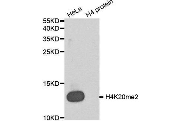 Histone H4 antibody  (2meLys20)