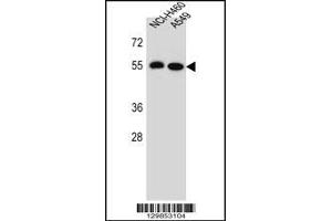 Western blot analysis in NCI-H460,A549 cell line lysates (35ug/lane). (LRRC6 antibody  (AA 179-207))