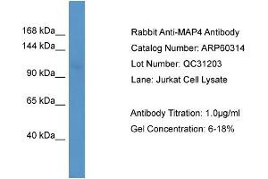 WB Suggested Anti-MAP4  Antibody Titration: 0. (MAP4 antibody  (N-Term))