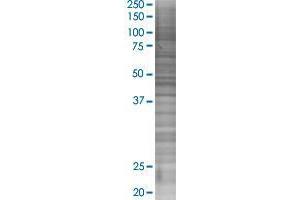 ACP6 transfected lysate. (ACP6 293T Cell Transient Overexpression Lysate(Denatured))