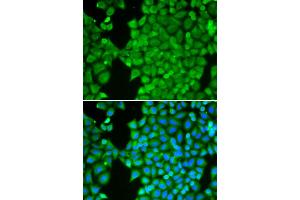 Immunofluorescence analysis of HeLa cells using CA3 antibody (ABIN6292665). (CA3 antibody)