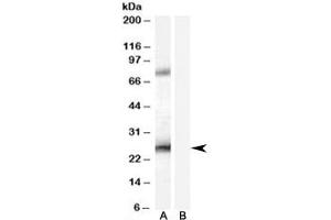 Western blot testing of A431 lysate with EBAG9 antibody at 0. (RCAS1 antibody)