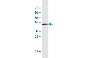 Western Blot detection against Immunogen (42. (Gastrin-Releasing Peptide antibody  (AA 1-148))