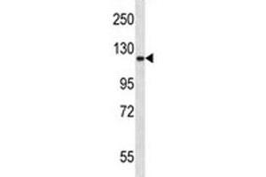 Epha2 antibody western blot analysis in mouse lung tissue lysate. (EPH Receptor A2 antibody  (AA 296-323))