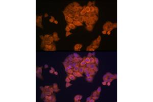 Immunofluorescence analysis of HeLa cells using PMP70/ Rabbit mAb (ABIN1683181, ABIN3018647, ABIN3018648 and ABIN7101638) at dilution of 1:100 (40x lens). (CX3CL1 antibody)