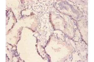 Immunohistochemistry of paraffin-embedded human prostate tissue using ABIN7167461 at dilution of 1:100 (ErbB2/Her2 antibody  (AA 153-598))