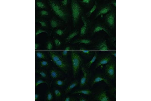 KIF14 antibody  (AA 1399-1648)