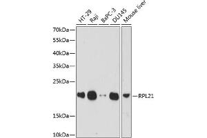 Western blot analysis of extracts of various cell lines, using RPL21 antibody (ABIN7269996) at 1:1000 dilution. (RPL21 antibody  (AA 1-160))