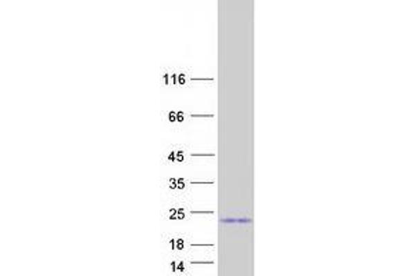 UBE2E1 Protein (Transcript Variant 2) (Myc-DYKDDDDK Tag)