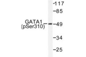 Image no. 1 for anti-GATA Binding Protein 1 (Globin Transcription Factor 1) (GATA1) (pSer310) antibody (ABIN318026) (GATA1 antibody  (pSer310))