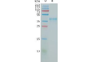 Human Protein, hFc Tag on SDS-PAGE under reducing condition. (CCR5 Protein (AA 1-30) (Fc Tag))