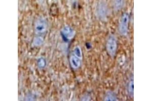 IHC-P analysis of Brain tissue, with DAB staining. (Superoxide dismutase copper chaperone antibody  (AA 17-270))