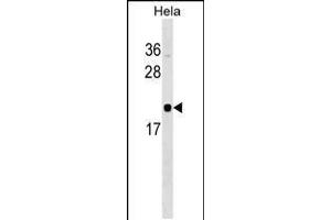 Western blot analysis in Hela cell line lysates (35ug/lane). (RWDD1 antibody  (N-Term))