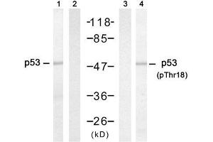 Western blot analysis of extracts from HT-29 cells untreated or treated with hydroxyurea, using p53 (Ab-18) antibody (E021086, Lane 1 and 2) and p53 (phospho-Thr18) antibody (E011095, Lane 3 and 4). (p53 antibody  (pThr18))