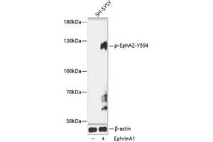 Western blot analysis of extracts of SH-SY5Y cells, using Phospho-EPH-Y594 antibody (ABIN7266968) at 1:1000 dilution. (EPH Receptor A2 antibody  (pTyr594))