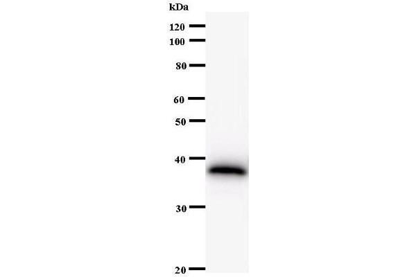 AHCTF1 antibody