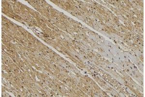 ABIN6272868 at 1/100 staining Mouse muscle tissue by IHC-P. (YME1L1 antibody  (C-Term))