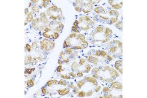 Immunohistochemistry of paraffin-embedded human stomach using PIK3CA antibody. (PIK3CA antibody)