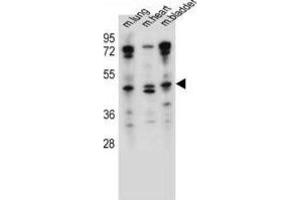 Western Blotting (WB) image for anti-Naked Cuticle Homolog 1 (NKD1) antibody (ABIN2997434) (NKD1 antibody)