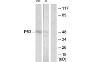 Western blot analysis of extracts from 293/Jurkat cells, treated with UV, using p53 (Ab-33) Antibody. (p53 antibody  (AA 16-65))