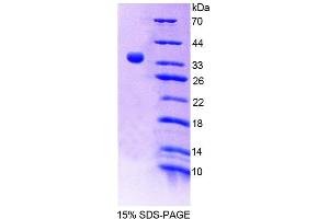 SDS-PAGE analysis of Mouse BPNT1 Protein. (BPNT1 Protein)