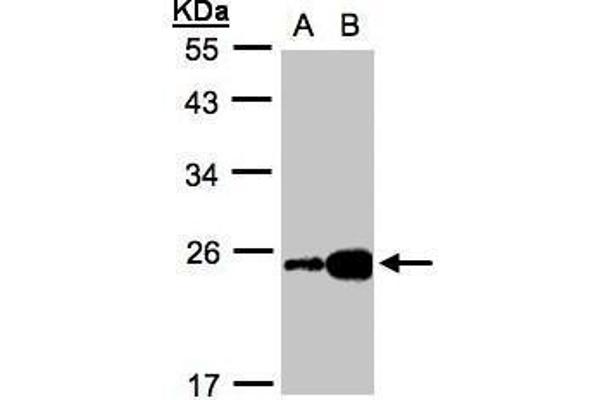 FABP6 antibody