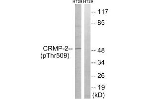 Western blot analysis of extracts from HT-29 cells, treated with heat shock, using CRMP2 (Phospho-Thr509) antibody. (DPYSL2 antibody  (pThr509))